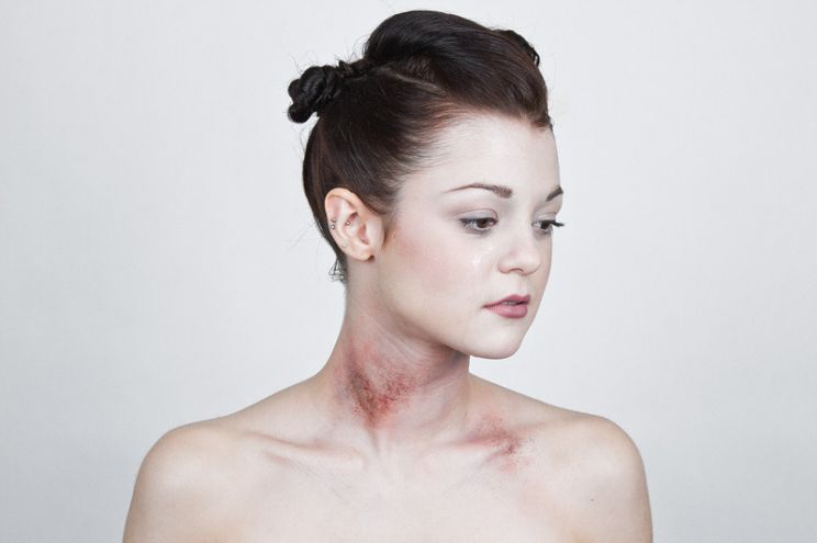 Kathryn Prescott