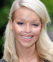 Katie Piper