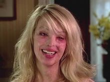 Katie Piper