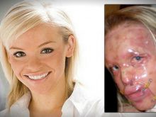 Katie Piper