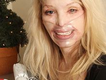 Katie Piper
