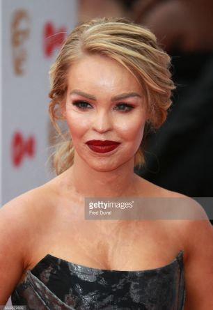 Katie Piper