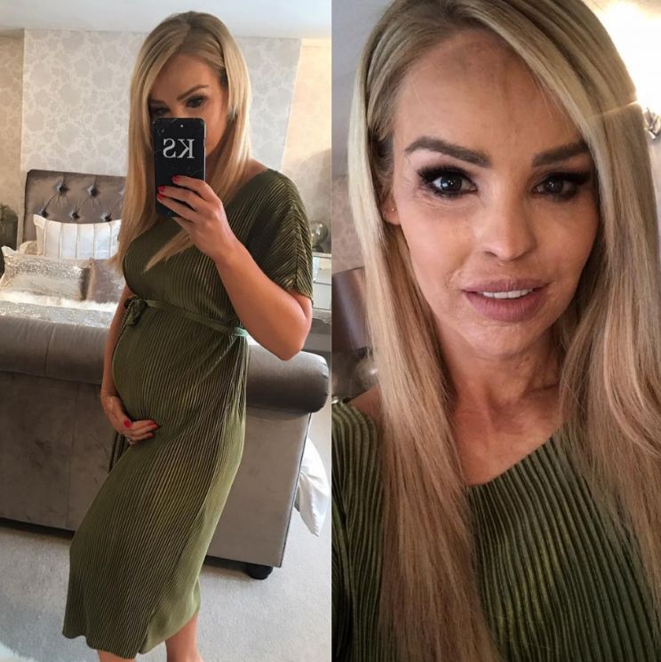 Katie Piper