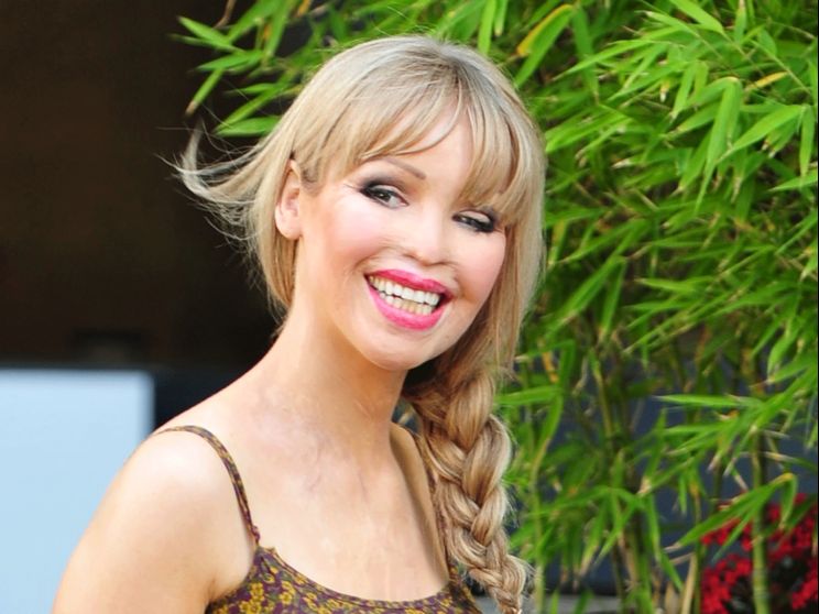 Katie Piper