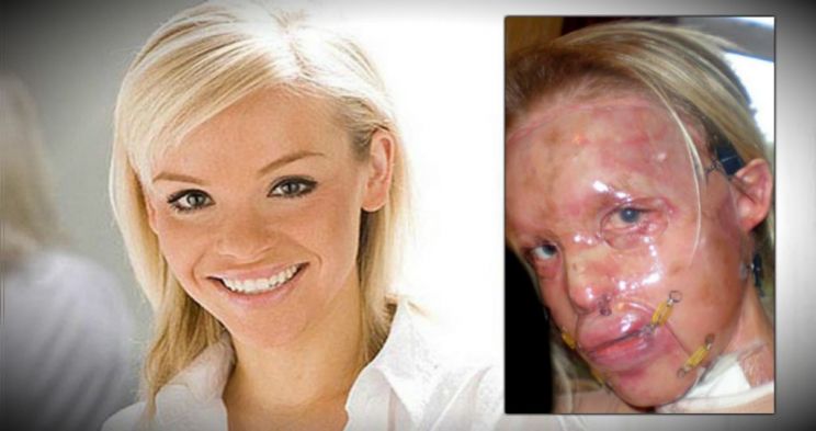 Katie Piper