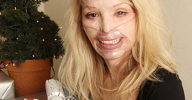Katie Piper