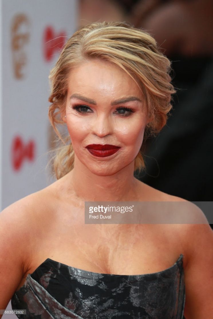 Katie Piper