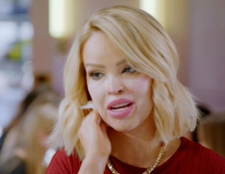 Katie Piper