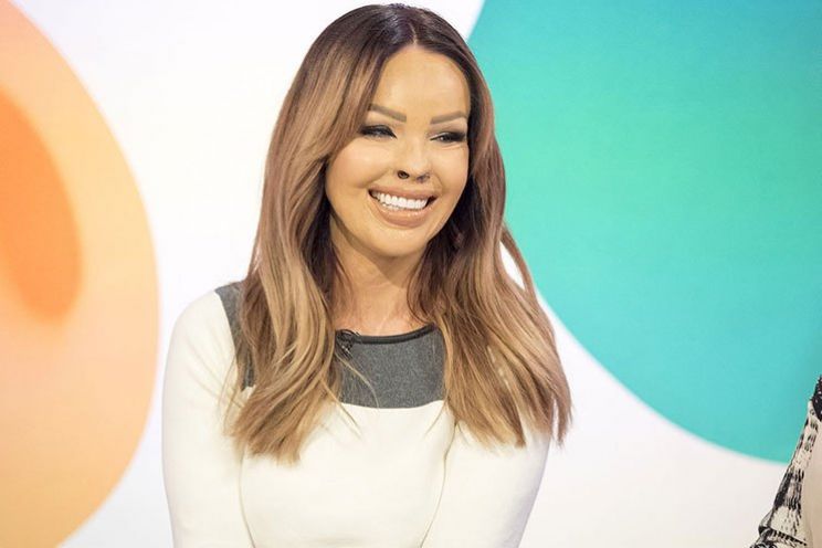 Katie Piper