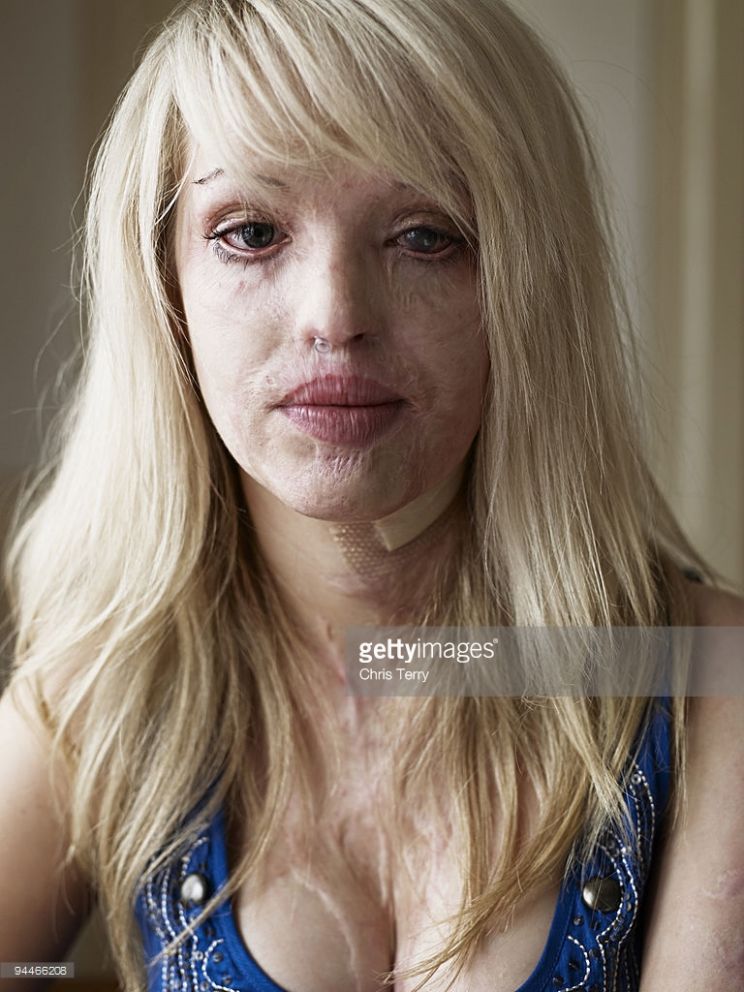 Katie Piper