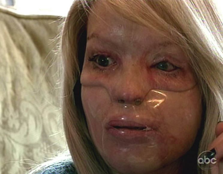 Katie Piper