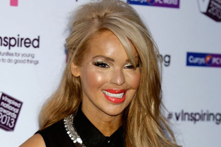 Katie Piper