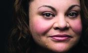 Keala Settle