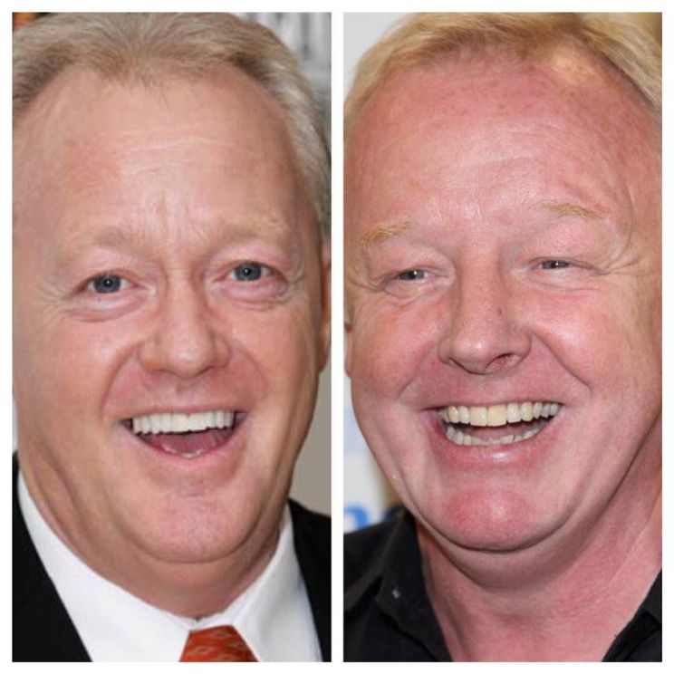 Keith Chegwin