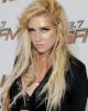 Kesha