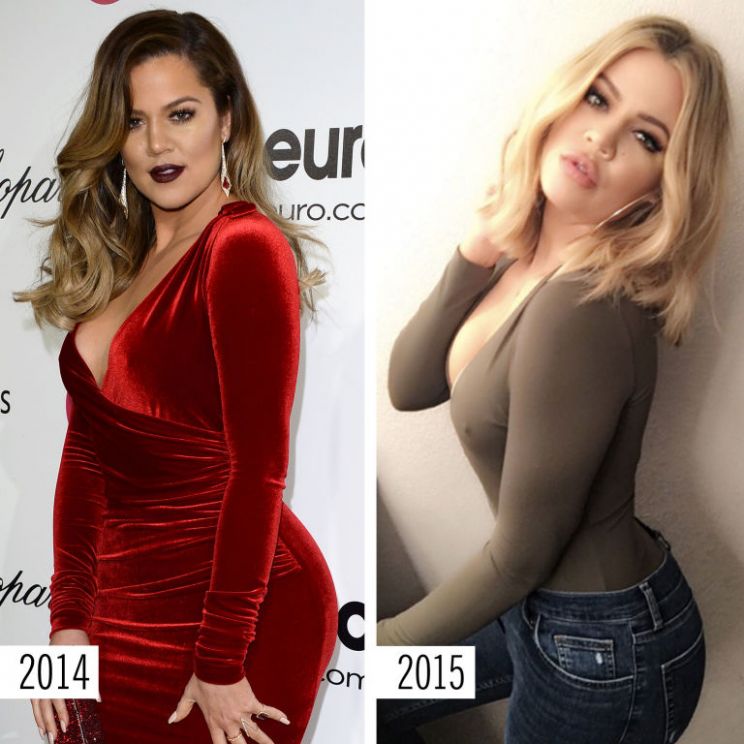 Khloé Kardashian