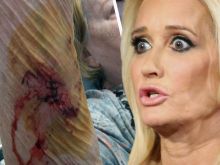 Kim Richards