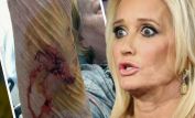 Kim Richards