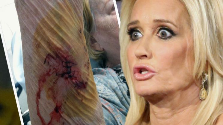 Kim Richards