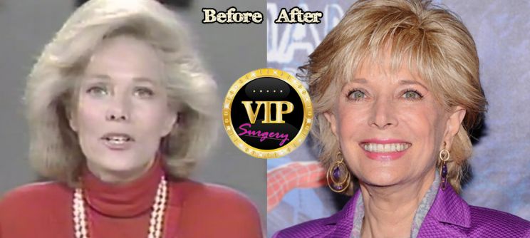 Lesley Stahl