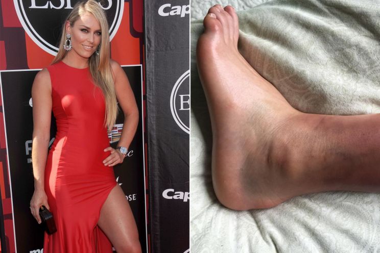 Lindsey Vonn