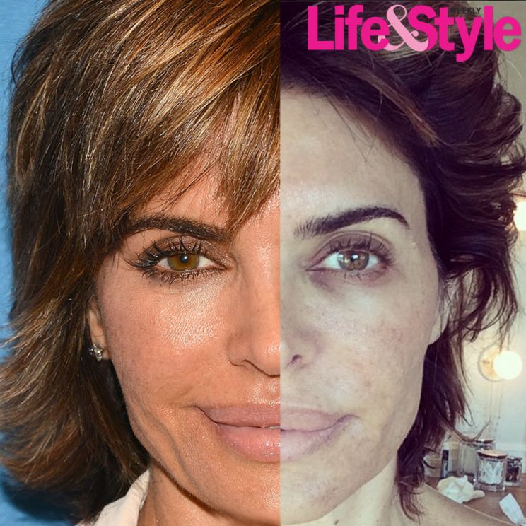 Lisa Rinna