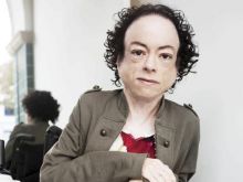 Liz Carr