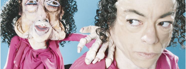Liz Carr