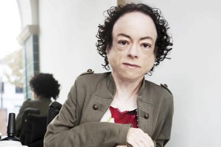 Liz Carr