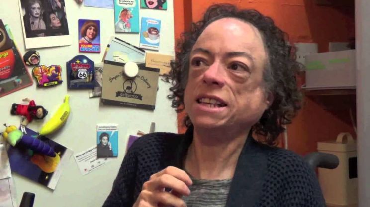 Liz Carr