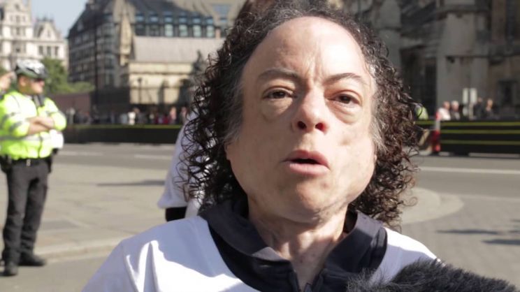 Liz Carr
