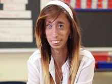 Lizzie Velasquez