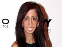 Lizzie Velasquez