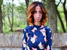 Lizzie Velasquez