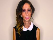 Lizzie Velasquez