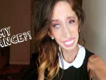 Lizzie Velasquez