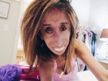 Lizzie Velasquez