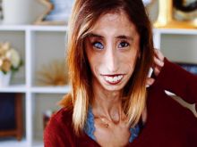 Lizzie Velasquez