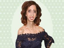 Lizzie Velasquez