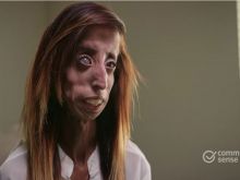 Lizzie Velasquez