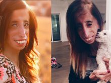 Lizzie Velasquez