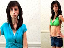 Lizzie Velasquez