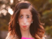 Lizzie Velasquez