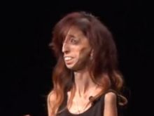 Lizzie Velasquez