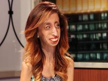 Lizzie Velasquez