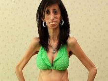 Lizzie Velasquez