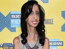 Lizzie Velasquez