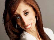 Lizzie Velasquez