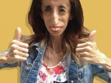 Lizzie Velasquez