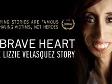 Lizzie Velasquez